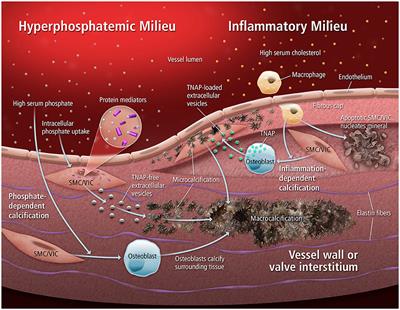 Roles and Regulation of Extracellular Vesicles in Cardiovascular Mineral Metabolism